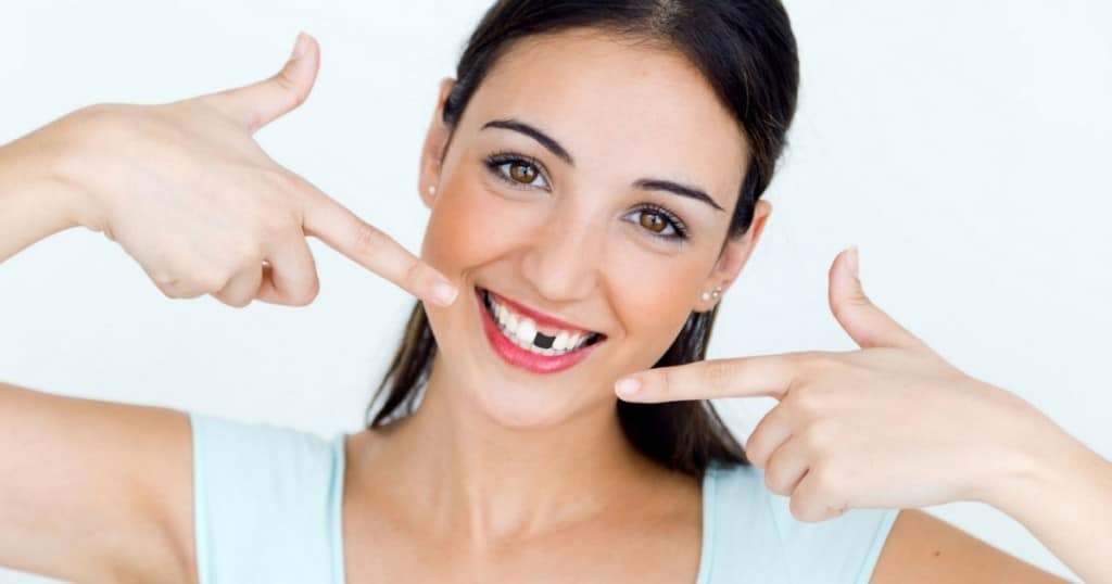 RIAVERE I DENTI FISSI? MAI STATO COSI SEMPLICE!